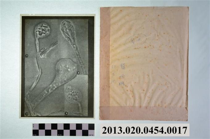 民國62年5月25日賴炳琳真菌顯微底片 (共2張)
