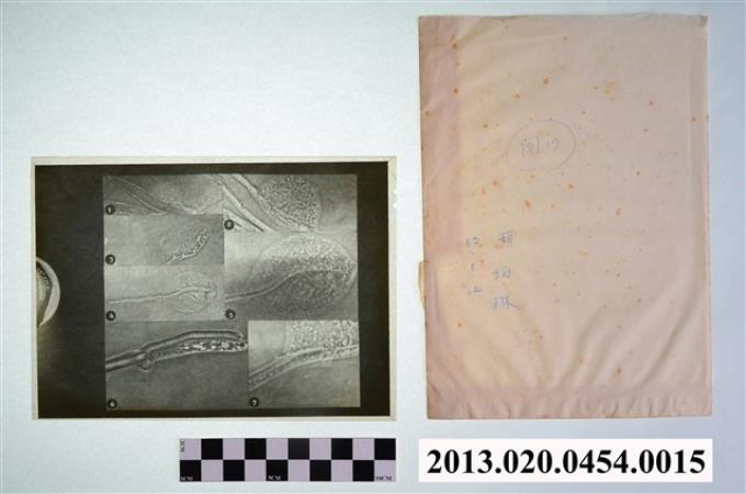 民國62年5月14日賴炳琳真菌顯微底片 (共2張)